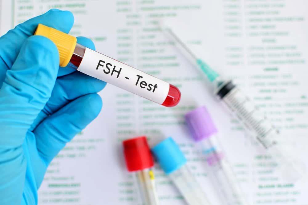xet-nghiem-fsh