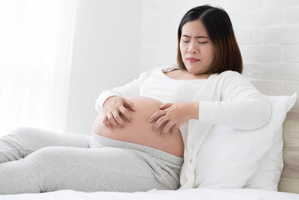 Mẹ bầu bị nổi mề đay khi mang thai: Nguyên nhân và cách chữa hiệu quả