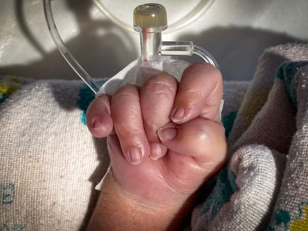 Thông liên nhĩ có nguy hiểm không và cách phòng ngừa biến chứng?