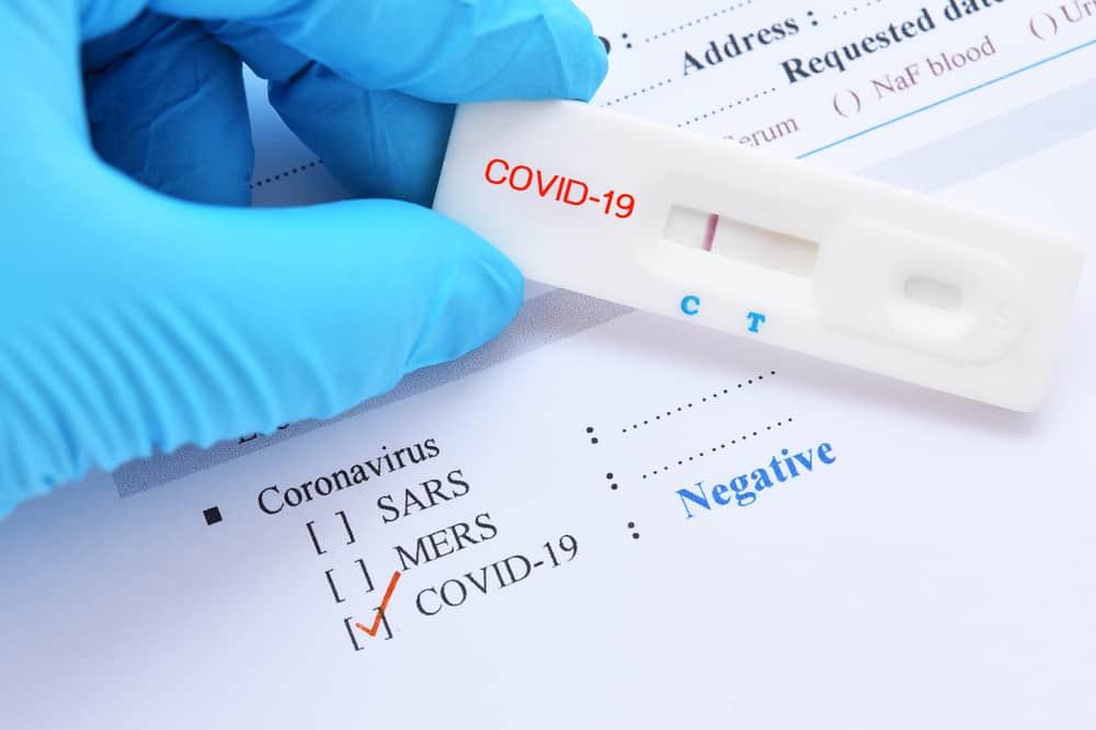 kit-test-nhanh-covid-19