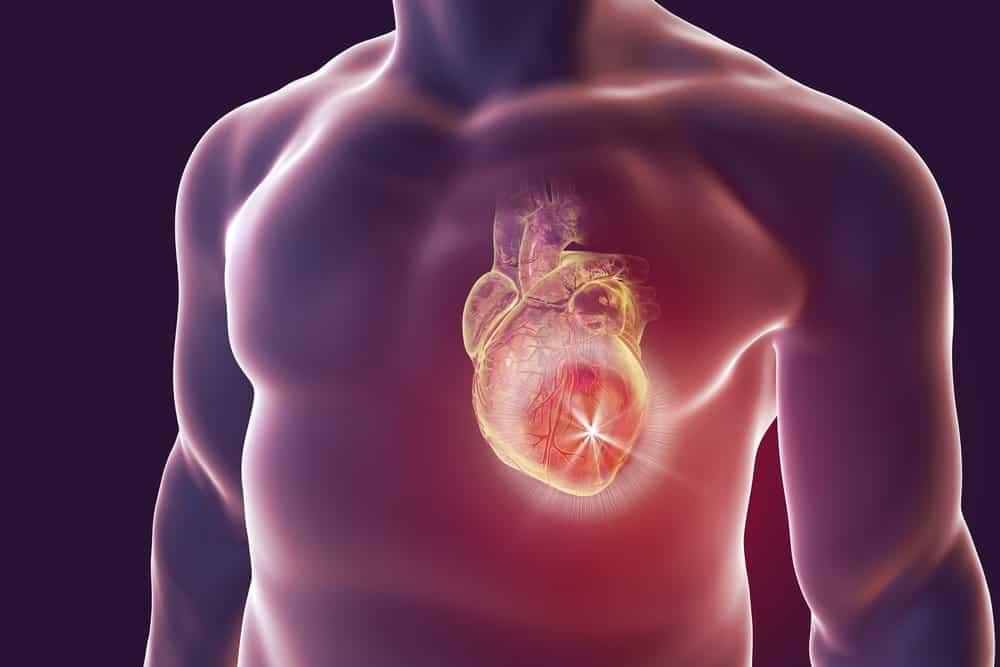 Nguyên nhân hở van tim là do đâu? Yếu tố nguy cơ và phòng ngừa
