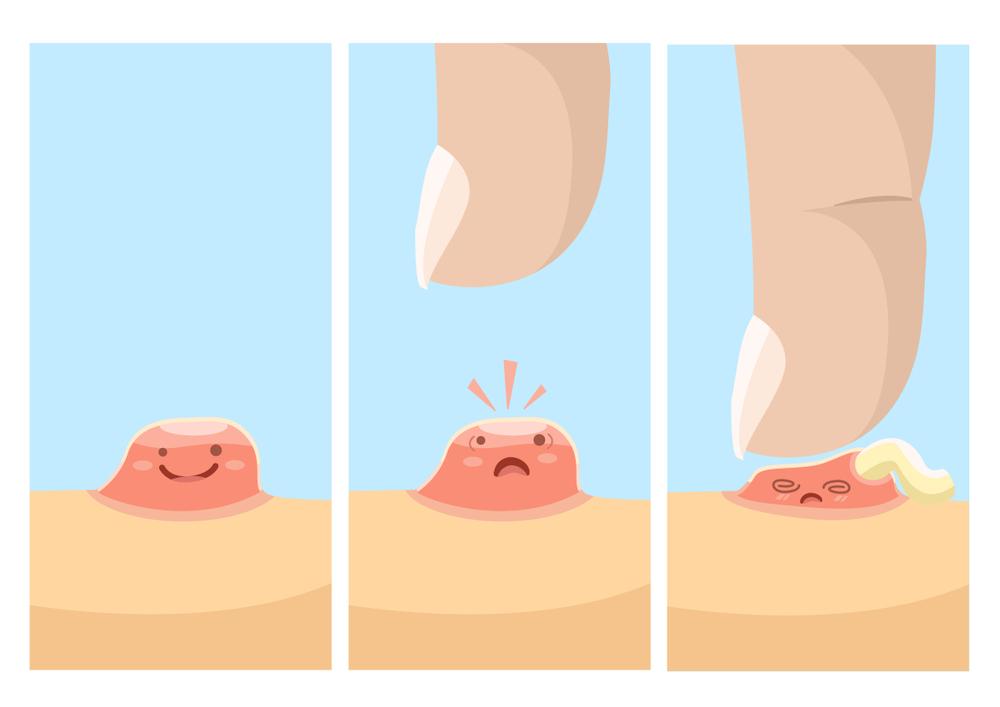 Vòng đời của mụn: Hiểu rõ để rút ngắn thời gian trị mụn