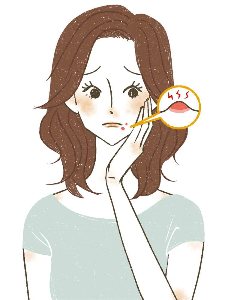 Cách trị mụn quanh miệng tại nhà hiệu quả