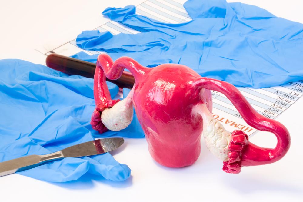 Phẫu thuật cắt 1 bên vòi trứng có ảnh hưởng gì không?