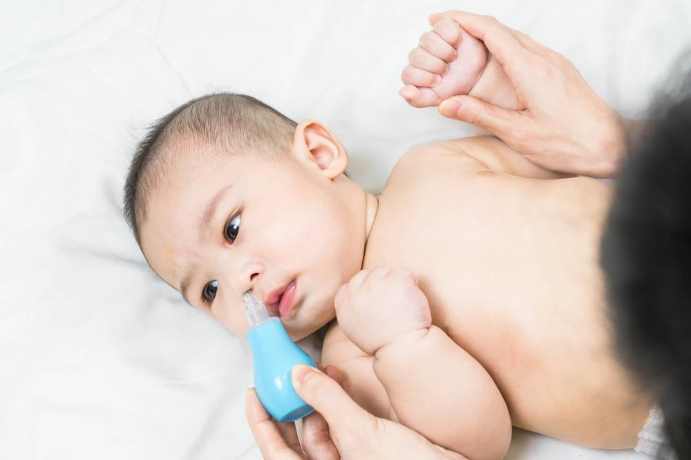 Hỏi đáp Bác sĩ: Có nên lấy gỉ mũi cho trẻ sơ sinh thường xuyên không?