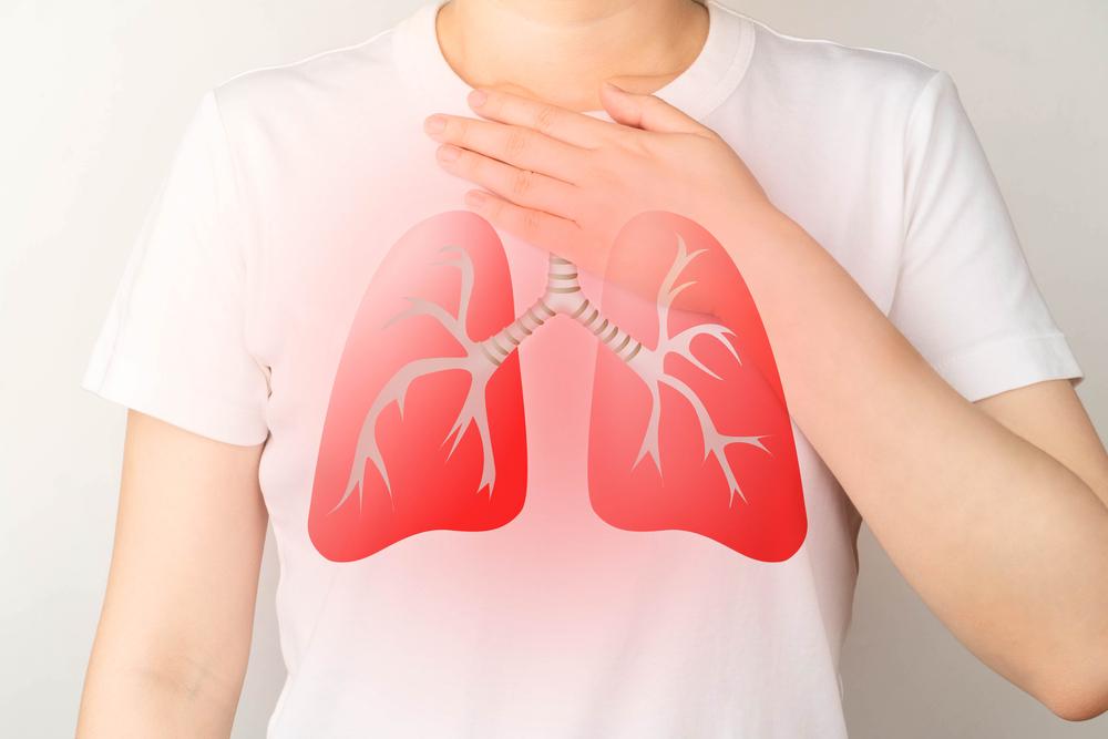 Giải đáp tràn dịch màng phổi có nguy hiểm không?