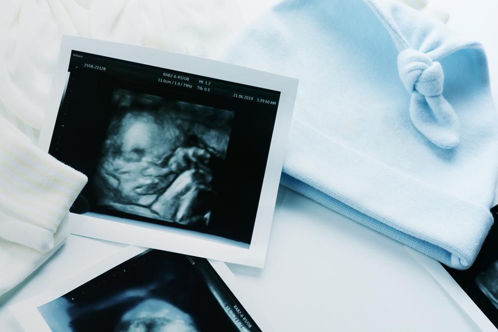 Siêu âm hình thái học là gì? Siêu âm hình thái học tuần bao nhiêu?