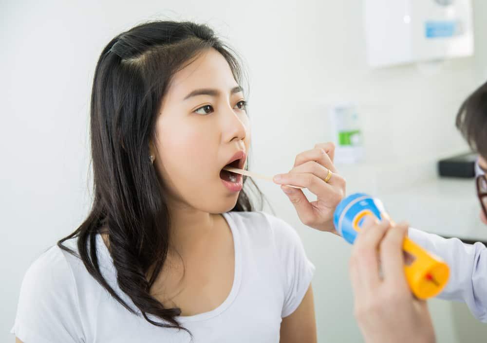 Bạch sản dạng lông ở miệng là bệnh gì? Những điều bạn cần biết