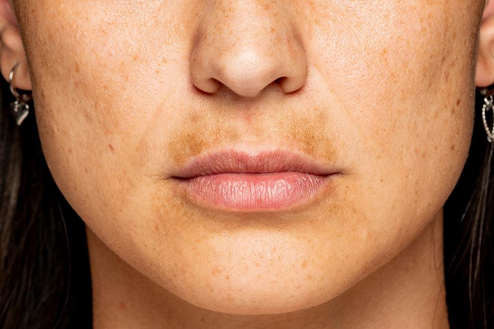 Khám phá 7 cách skincare cho da không đều màu