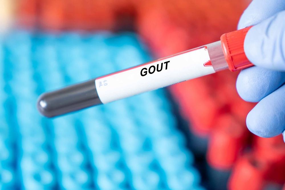 nguyen-nhan-benh-gout