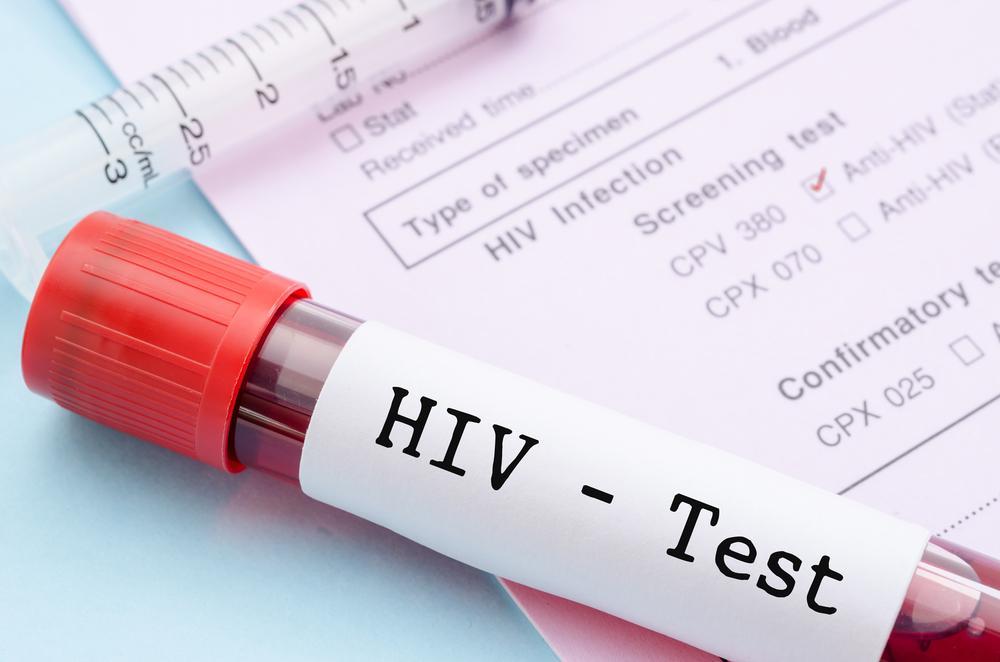 xet-nghiem-hiv-ab-test-nhanh-co-chinh-xac-khong