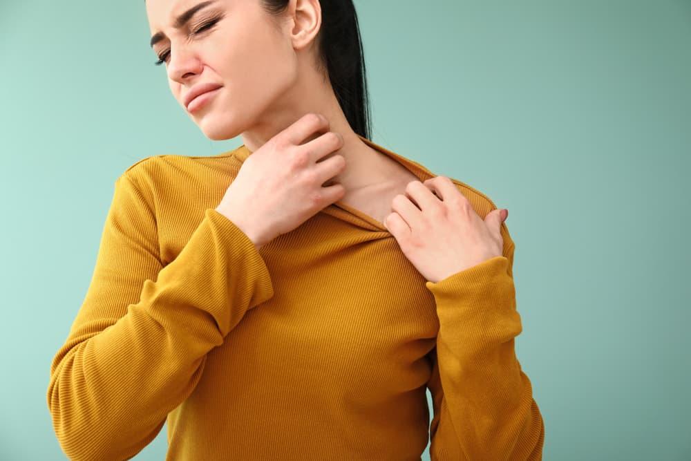 Bị nổi mề đay liên tục, kéo dài phải làm sao?
