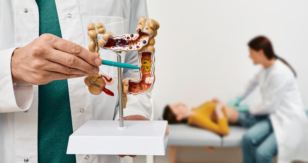 Tầm soát ung thư đại tràng bằng cách nào?