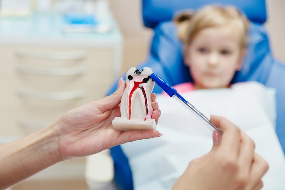 9 biện pháp khắc phục tình trạng răng trẻ bị đen hiệu quả, đơn giản