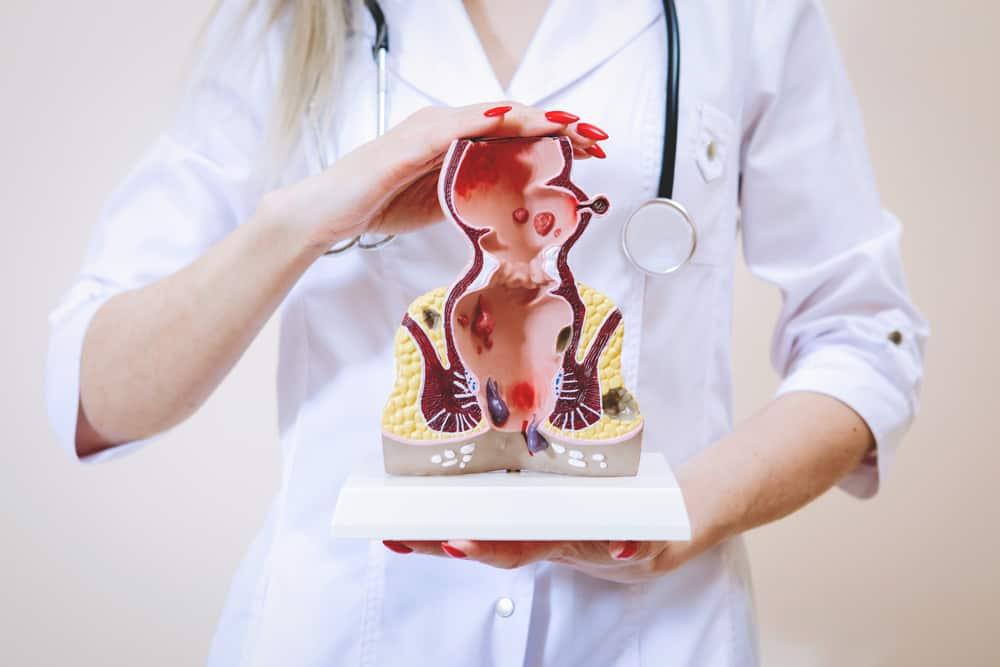 Khi nào nên cắt trĩ? Quy trình thực hiện và rủi ro bạn có thể gặp phải