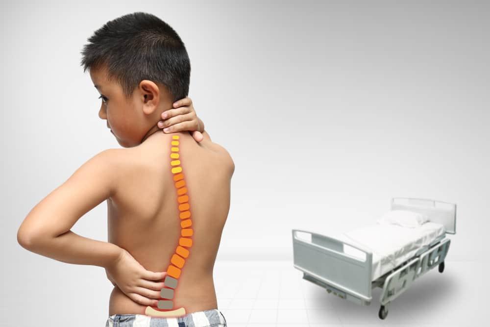 Cong vẹo cột sống