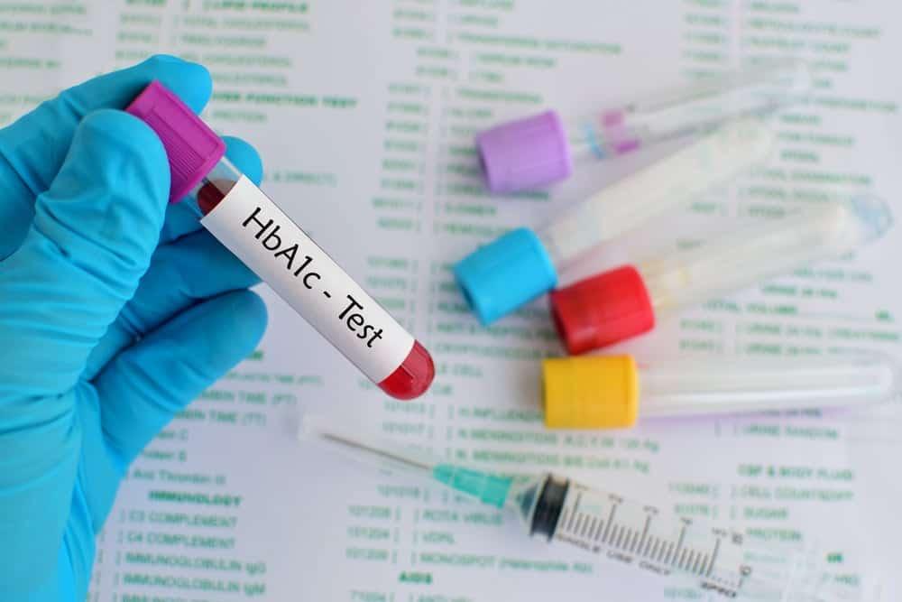 chi-so-hba1c-bao-nhieu-la-bi-tieu-duong