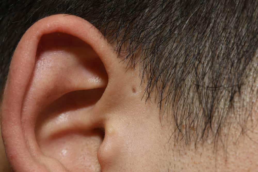 Giải đáp thắc mắc: Rò luân nhĩ là gì? Có nguy hiểm không?