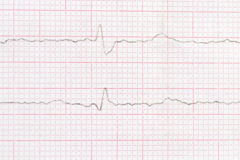 Block nhánh trái và những thông tin bạn cần biết