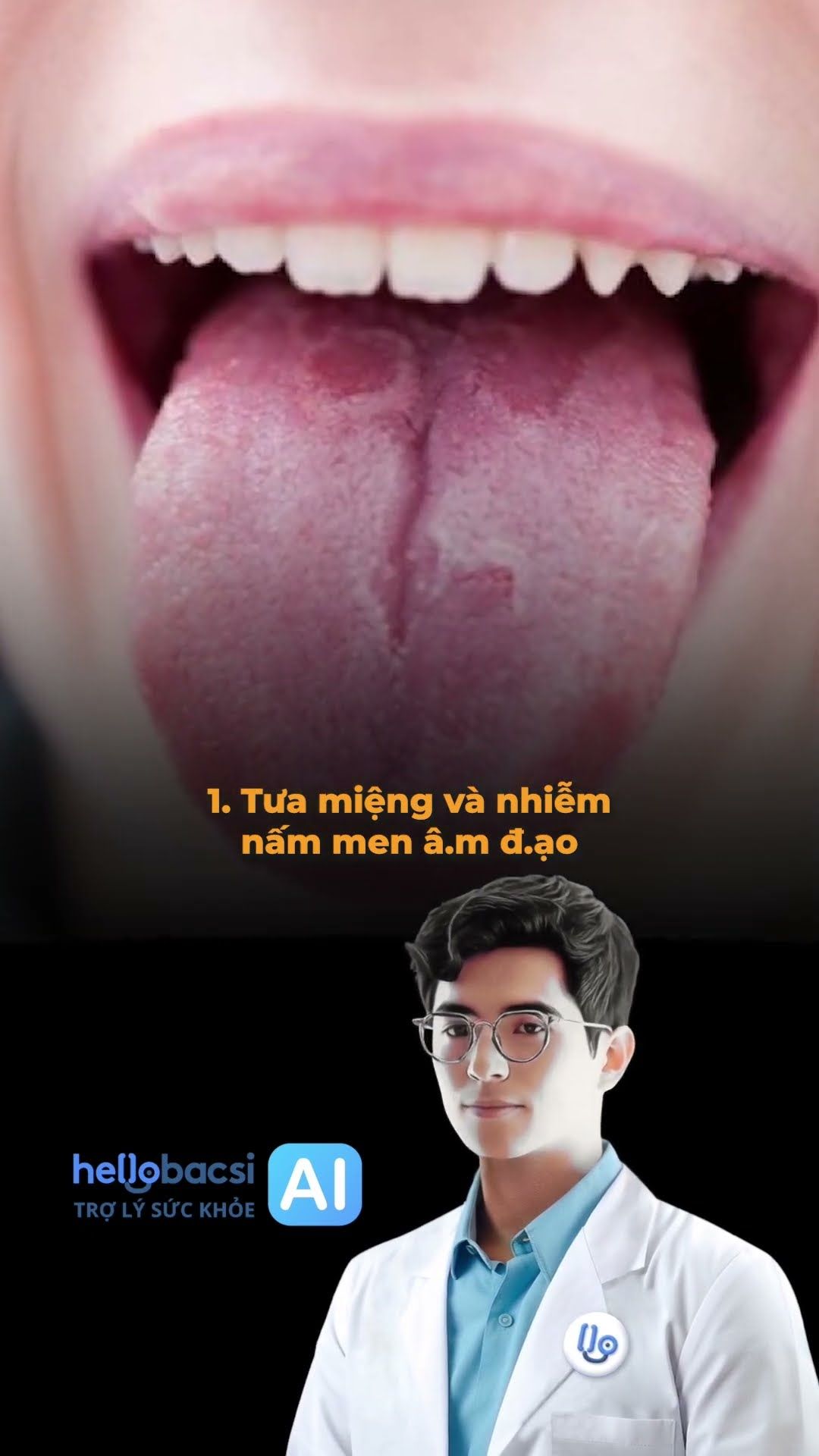 3 dấu hiệu cảnh báo bệnh tiểu đường đặc trưng ở phụ nữ