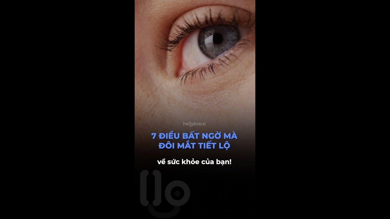 7 điều đôi mắt tiết lộ về sức khoẻ của bạn