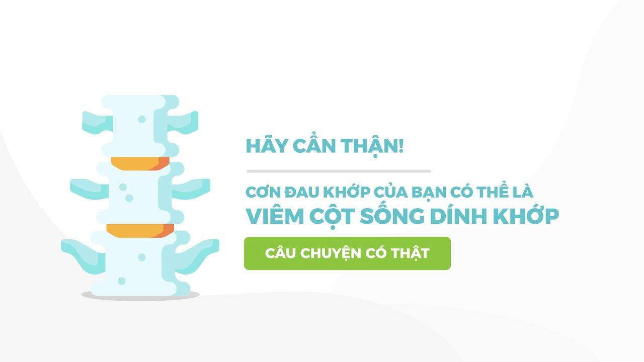 Hãy cẩn thận! Cơn đau khớp của bạn có thể là viêm cột sống dính khớp
