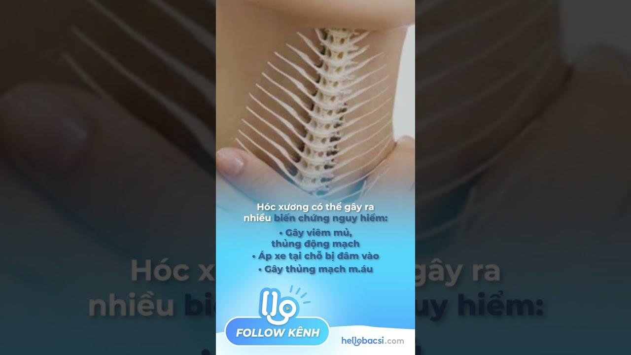 Người đàn ông đi cấp cứu vì đau bụng!!!